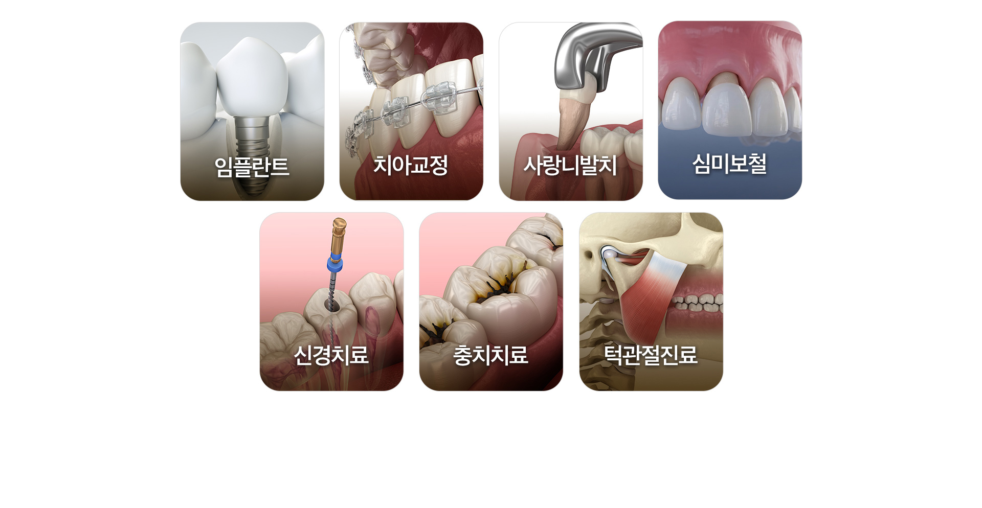 임플란트, 치아교정, 사랑니발치, 심미보철, 신경치료, 충치치료, 턱관절진료