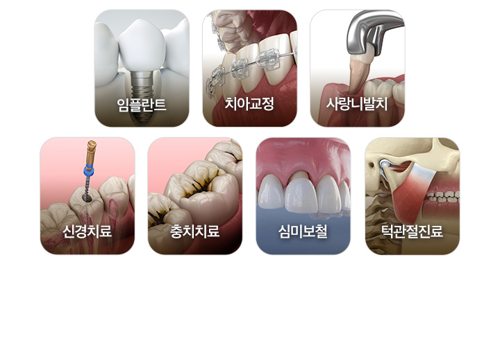 임플란트, 치아교정, 사랑니발치, 심미보철, 신경치료, 충치치료, 턱관절진료